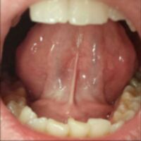 skippy2310 Thumbnail